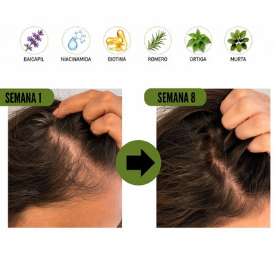 Shampoo Anti Caída Baicapil 3,1%+ Romero (Crecimiento y Fortalecimiento Capilar)